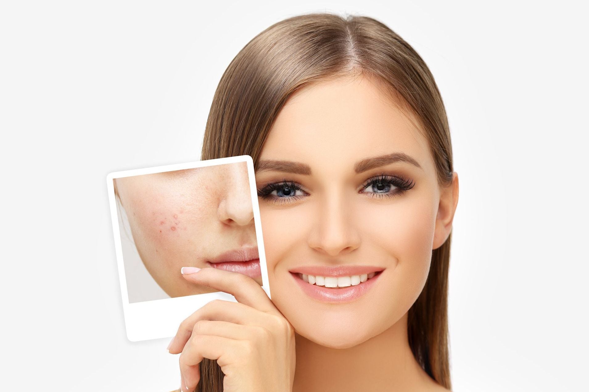 Matrix RF – Sherlase Clinic & Spa