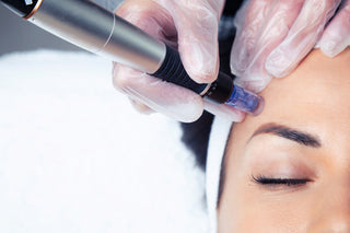 Microneedling with EXO|E Exosomes